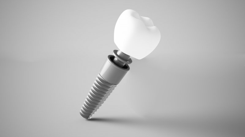 Dental implant