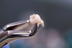 Close up of a cleaned, extracted tooth